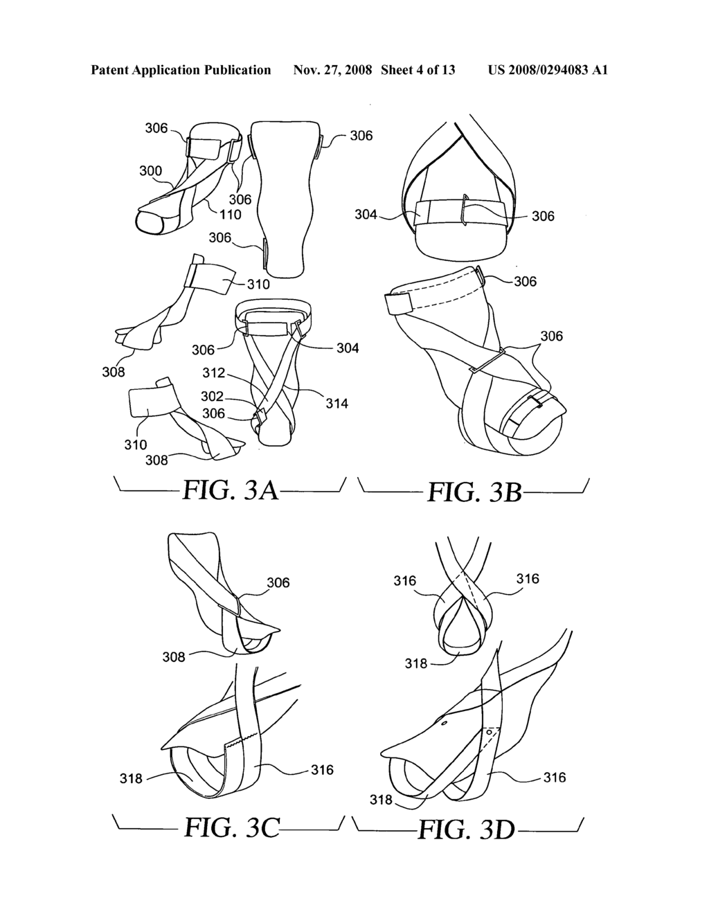 Orthopedic device - diagram, schematic, and image 05