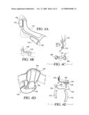 Orthopedic device diagram and image