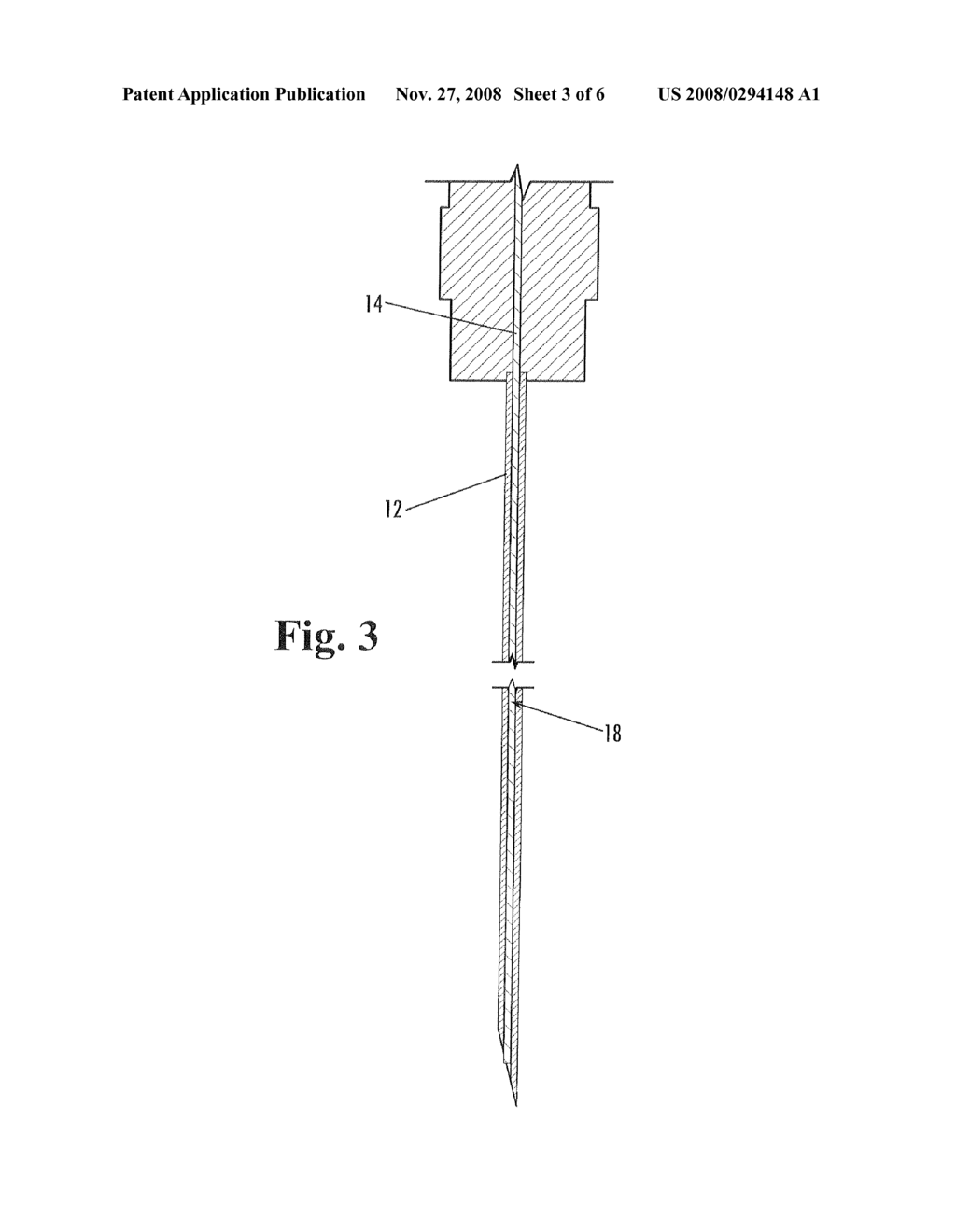 SYSTEM AND METHOD FOR REFILLING AN IMPLANTED DELIVERY DEVICE - diagram, schematic, and image 04