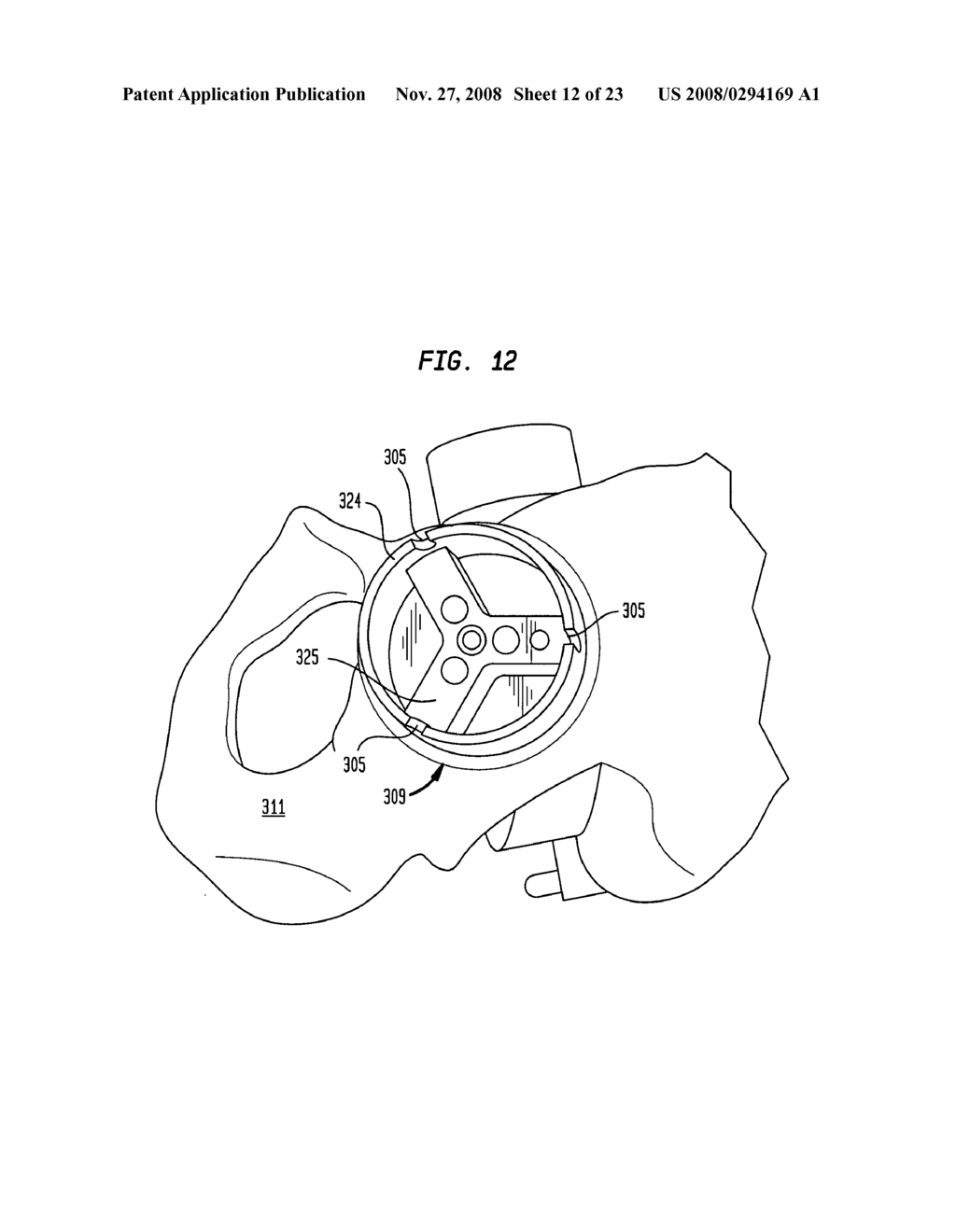 Bone-reaming system - diagram, schematic, and image 13