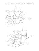 Spinous process implants and methods of using the same diagram and image