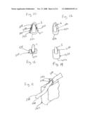 Spinous process implants and methods of using the same diagram and image