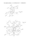 Spinous process implants and methods of using the same diagram and image