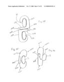 Spinous process implants and methods of using the same diagram and image