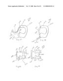 Spinous process implants and methods of using the same diagram and image