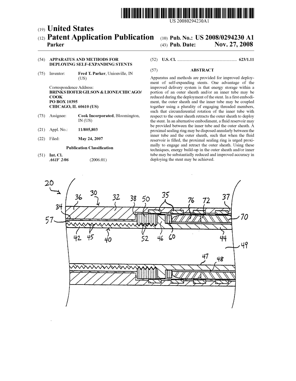 Apparatus and methods for deploying self-expanding stents - diagram, schematic, and image 01