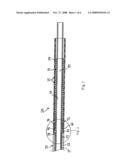 Apparatus and methods for deploying self-expanding stents diagram and image