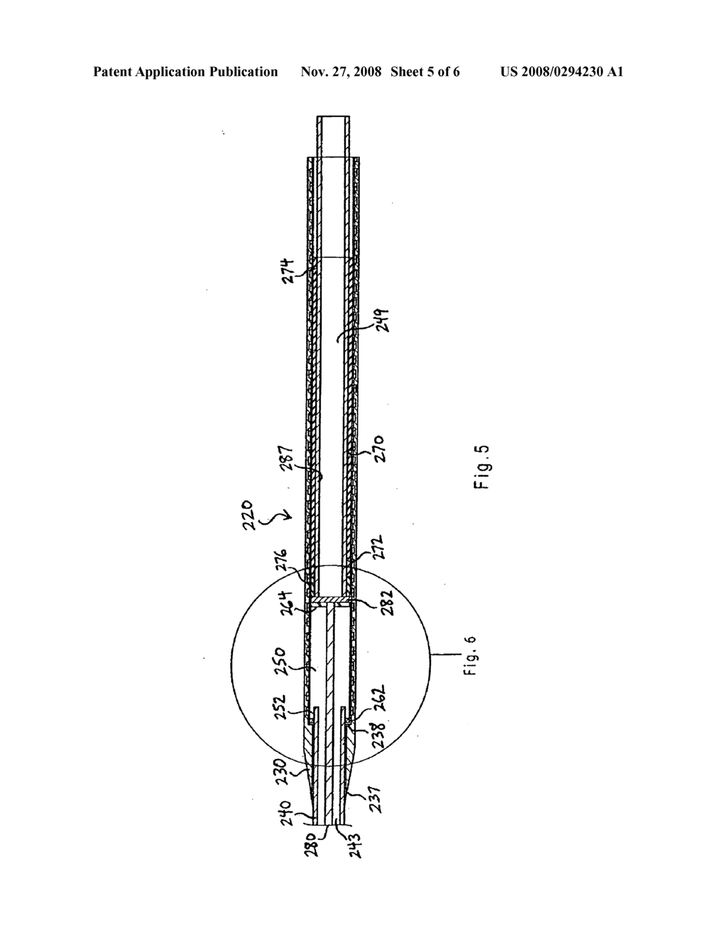 Apparatus and methods for deploying self-expanding stents - diagram, schematic, and image 06