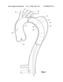 STENT GRAFTS FOR THE THORACIC AORTA diagram and image