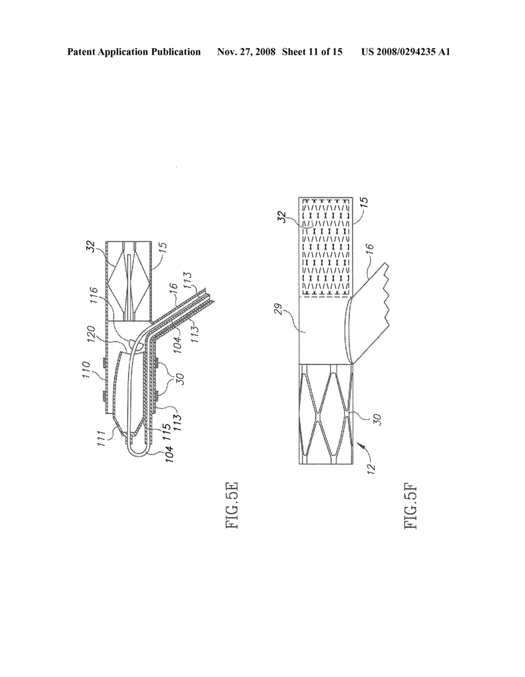 BYPASS GRAFT DEVICE AND DELIVERY SYSTEM AND METHOD - diagram, schematic, and image 12