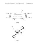 Flexible stent with elevated scaffolding properties diagram and image