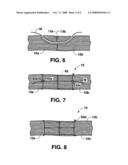 Methods and Materials for Connective Tissue Repair diagram and image