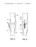 Methods and Materials for Connective Tissue Repair diagram and image