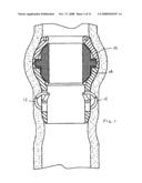 Gastrointestinal Device diagram and image