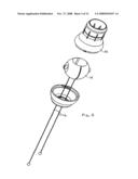 Gastrointestinal Device diagram and image