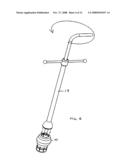 Gastrointestinal Device diagram and image