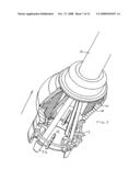 Gastrointestinal Device diagram and image