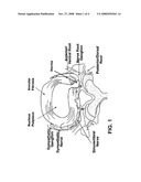 Method for treating herniated discs diagram and image