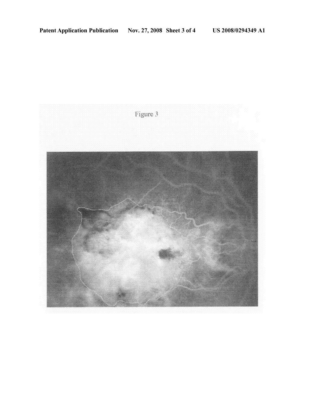 Quantitative Evaluation and Image Analysis of Choroidal Neovascular Membrane and Other Retinal and Subretinal Lesions - diagram, schematic, and image 04