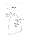 BRIDGE ELEMENT FOR LUNG IMPLANT diagram and image