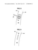 BRIDGE ELEMENT FOR LUNG IMPLANT diagram and image