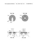 BRIDGE ELEMENT FOR LUNG IMPLANT diagram and image