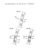 BRIDGE ELEMENT FOR LUNG IMPLANT diagram and image