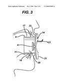 ENDOSCOPIC BITE BLOCK FOR USE WITH CANNULA diagram and image
