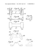 INTEROCCLUSAL APPLIANCE AND METHOD diagram and image