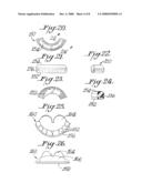 INTEROCCLUSAL APPLIANCE AND METHOD diagram and image