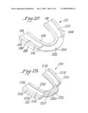 INTEROCCLUSAL APPLIANCE AND METHOD diagram and image