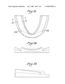 INTEROCCLUSAL APPLIANCE AND METHOD diagram and image