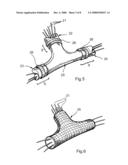 Electrical-Cable Shielding diagram and image