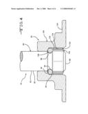 Retention system diagram and image