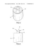 RETENTION DEVICE diagram and image