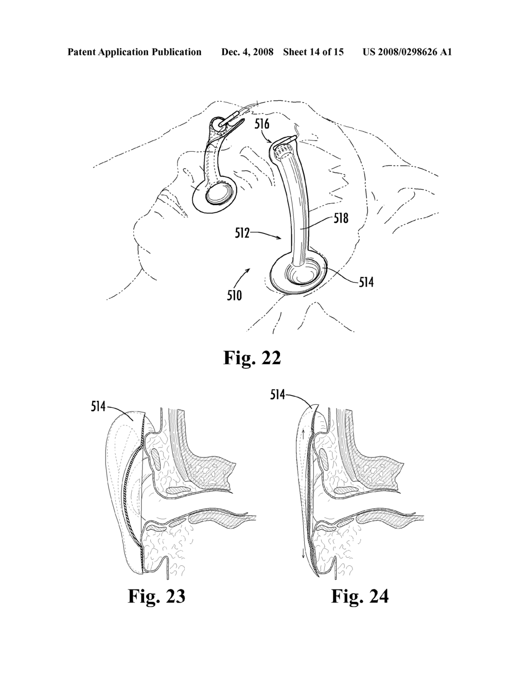 AUDIO EARBUD CARRIER - diagram, schematic, and image 15