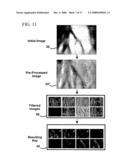 Method and apparatus for extraction and matching of biometric detail diagram and image