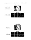 Method and apparatus for extraction and matching of biometric detail diagram and image