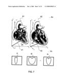 METHODS, APPARATUSES, AND SYSTEMS USEFUL IN CONDUCTING IMAGE GUIDED INTERVENTIONS diagram and image