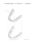 METHOD AND SYSTEM FOR PROVIDING ALTERNATING USE ORTHODONTIC ALIGNERS diagram and image