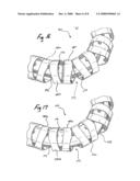 ACTIVE CONTROLLED BENDING IN MEDICAL DEVICES diagram and image