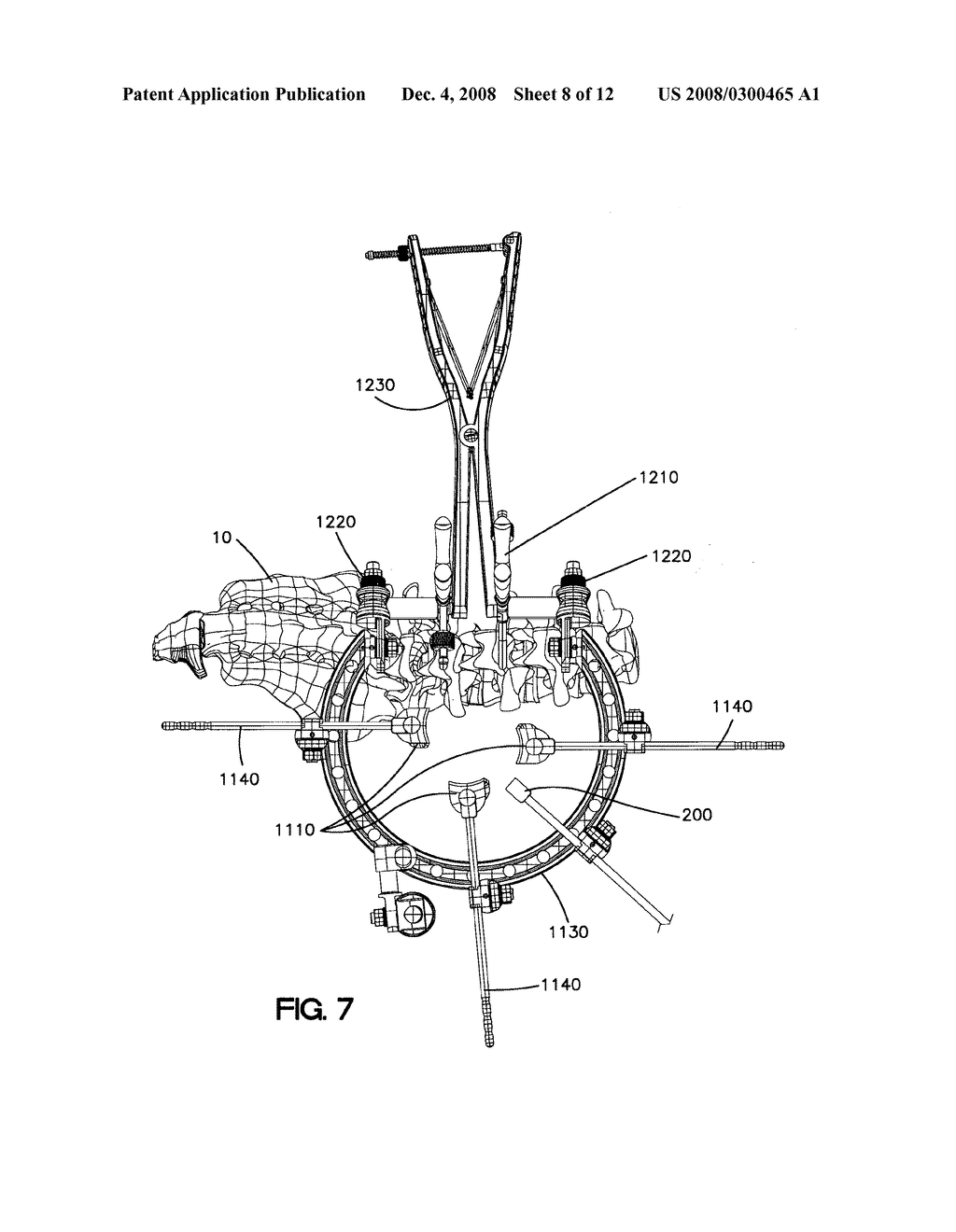 Spine Retractor and Distractor Device - diagram, schematic, and image 09