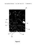 Optical microprobe for blood clot detection diagram and image