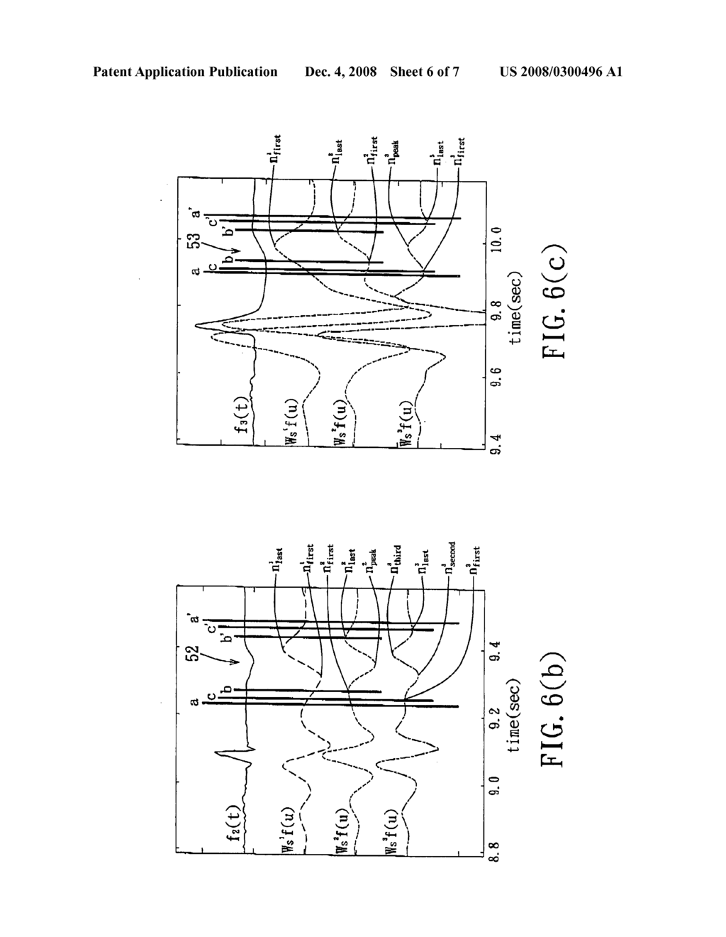 Method for delineation of characteristic points in an electrocardiogram signal, and storage medium, electronic device and electrocardiogram signal analyzing system for implementing the method - diagram, schematic, and image 07