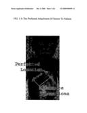 Portable Apnea and Cardiac Monitor diagram and image