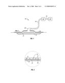 REDUCED PRESSURE WOUND DRESSING HAVING A WOUND CONTACT SURFACE WITH COLUMNAR PROTRUSIONS diagram and image