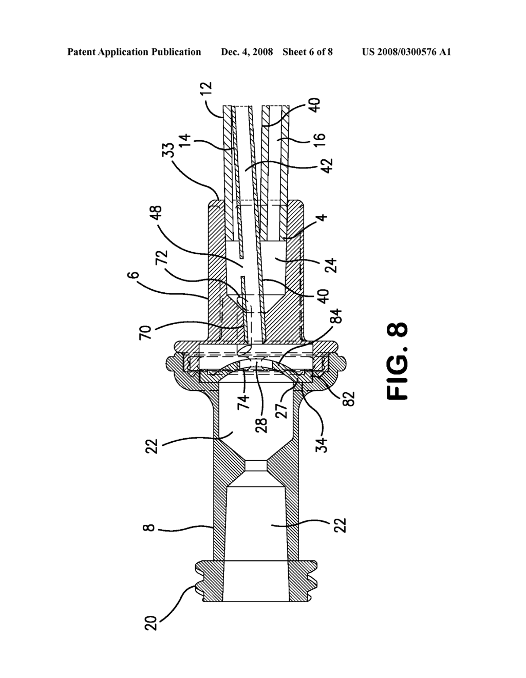 CATHETER INSERTION ASSEMBLY - diagram, schematic, and image 07