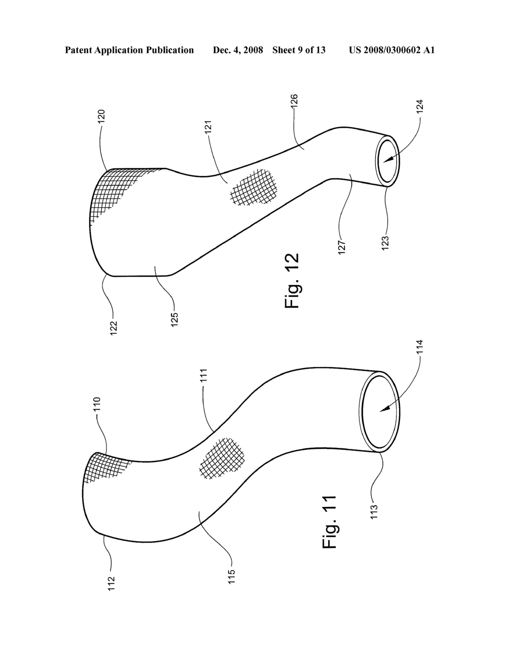 FABRIC MEDICAL DEVICE HAVING A TAPERED TRANSITION AND METHOD OF MAKING - diagram, schematic, and image 10