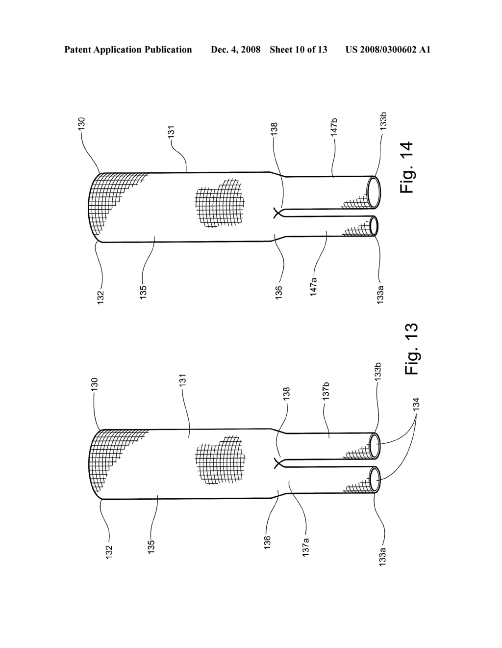 FABRIC MEDICAL DEVICE HAVING A TAPERED TRANSITION AND METHOD OF MAKING - diagram, schematic, and image 11