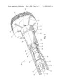 SUTURE LOCK diagram and image